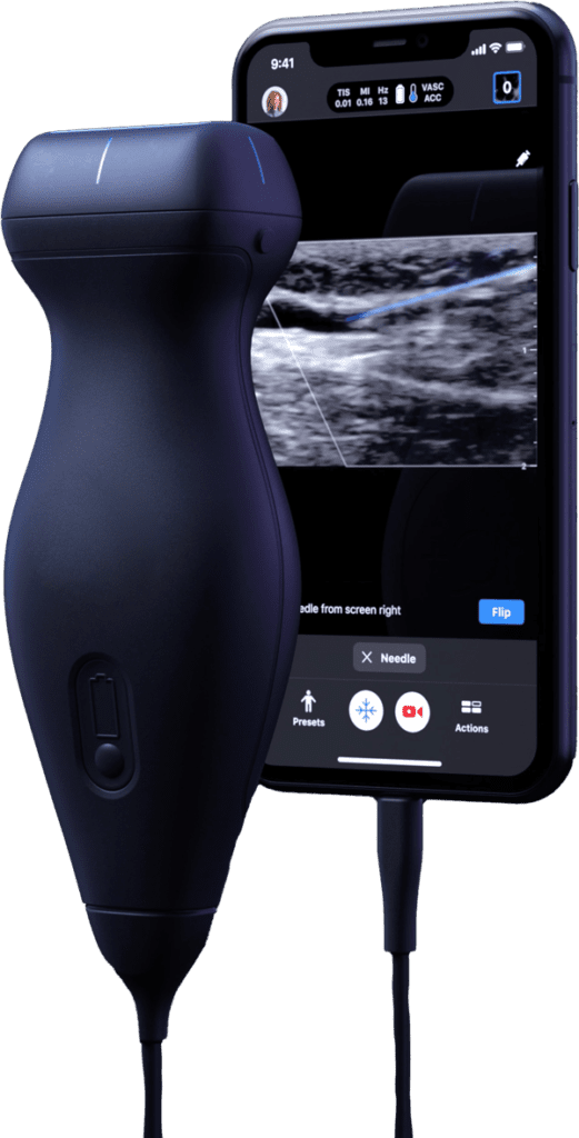new ultrasound technology